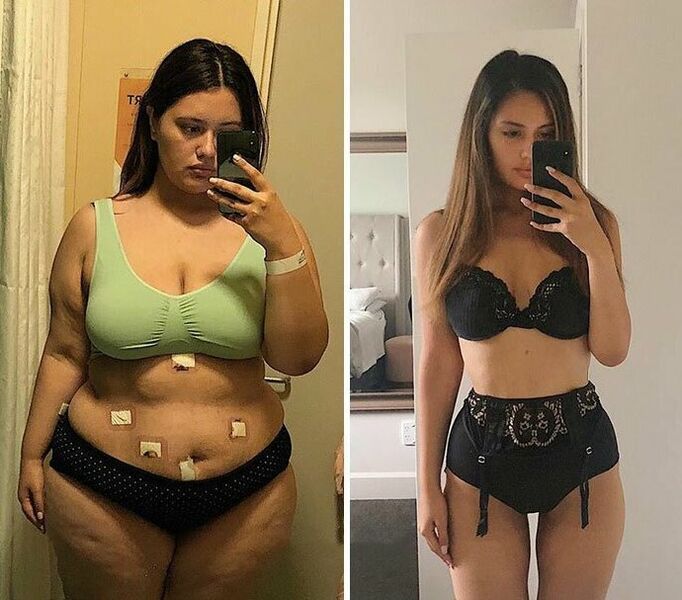 With KETO Complete capsules for girls before and after weight loss